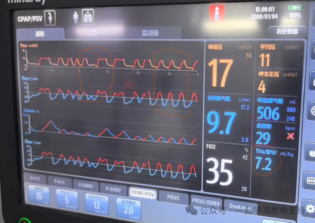 jackpot·(中国区)官方网站