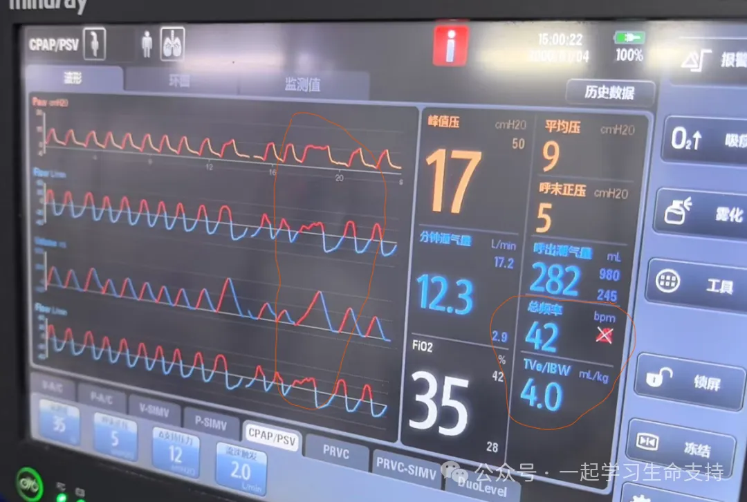 jackpot·(中国区)官方网站